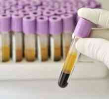 Krevní testy Petit: dekódování, odchylky frekvence