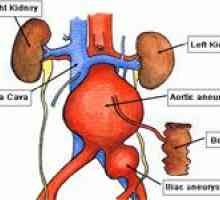 Břišní aorty a její léčba
