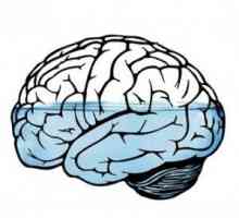 Hydrocefalus (otok mozku): příčiny, příznaky, jak se chovat, účinky