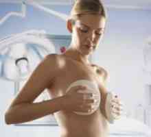 Endoprotéza prsní žláza jako metoda rekonstrukce po mastektomii