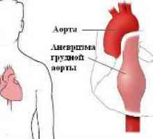 Klinické příznaky aorty