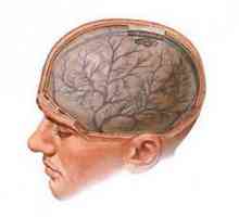 Mozkový edém: příčiny a formy, příznaky, léčba, komplikace a prognóza