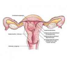 Polypy a endometrióza: Co je plná s touto kombinací?