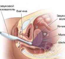 Aplikace Ultrazvuk v gynekologii