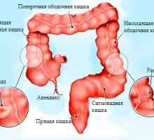 Příznaky a léčba rakoviny tlustého střeva