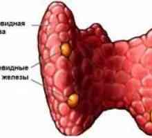 Onemocnění endokrinního systému hyperparatyreózy, symptomů a léčení