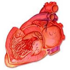 Příznaky ischemické choroby srdeční