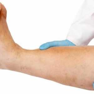 Otoky nohou mužů: příčiny, léčba a prevence