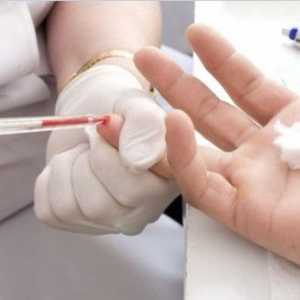 Příčiny, příznaky a léčba nízkým hemoglobin