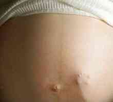 34 Týdnů těhotenství