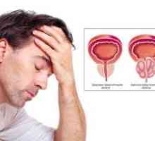 Adenom prostaty: příznaky a stádium onemocnění