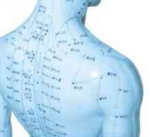 Akupunktura - aktivní pomoc při osteochondróze