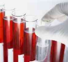 Krevní testy, výzkum na hormony a dekódování