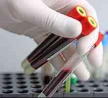 Klinická analýza krve nasazeny: účel a přepis analýza