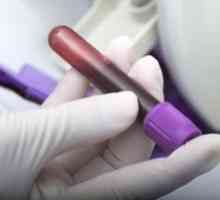 Krevní test na anti nvcor: jmenování a dekódování