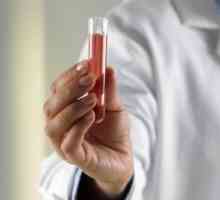 Krevní test pro imunitní status: indikace a vlastností