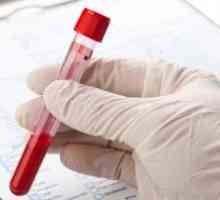Krevní test pro opisthorchiasis - příprava, postup, dekódování a léčení parazitárních nemocí