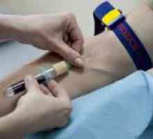 Co je krevní test rw a její interpretace