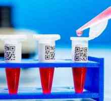 Krevní testy na rakovinných buňkách a její interpretace