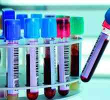 Testy na pohlavně přenosných chorob u mužů: druhu, účelu a možných výsledků