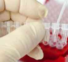 Kolik leukocytů v krvi je považováno za normální a co to závisí na tom,