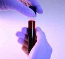 Krevní test pro revmatoidní faktor je funkce dekódování hodnoty a analýza