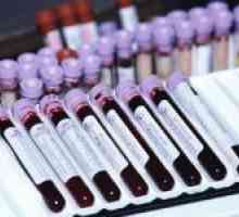 Rozbor krve biochemie a normy týkající se základních ukazatelů