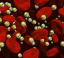 Co je krevní lipidogram a jak se hodnotí výkonnost této analýzy