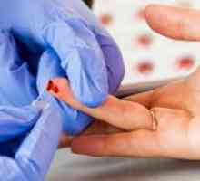 Krevní test - NST: normální hematokritu, a důvod pro odmítnutí