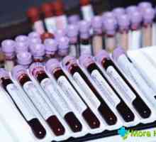 Krevní test v průběhu těhotenství: rozluštění základní ukazatele