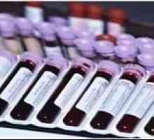 Analýza na TTG a příprava pro darování krve