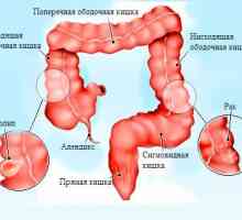 Anatomické struktury, onemocnění a léčba sigmatu