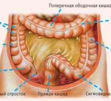 Anatomie a onemocnění tlustého střeva