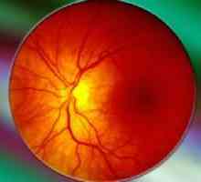 Sítnice angiopatie očí u dětí