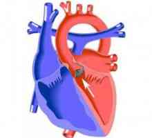Aortální stenóza / závada: příčiny, příznaky, chirurgii, prognóza