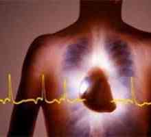 Sinus (sinus), nepravidelný srdeční rytmus