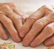 Artritida prstů: Tradiční terapie