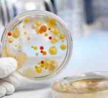 Bakteriologických v mikrobiologii: význam způsobu a milníky