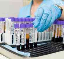 Biochemické vyšetření krve: dekódování tabulky pro hlavní hodnoty