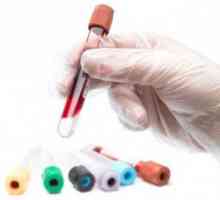 Biochemický rozbor krve: normou pro dospělé a děti, indikátory, jak se rozluštit výsledky