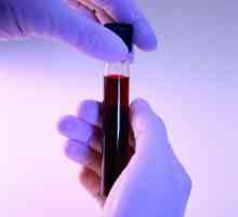 Biochemická analýza krve: příprava, hospodářství, dekódování a rychlost