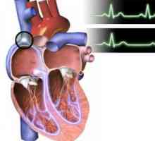 Bradykardie (nízká srdeční frekvence) u dětí a dospělých: druh, původ, projevy, diagnostika, léčba