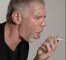 Kuřácký bronchitida