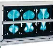 Divák X-ray může pomoci kardiologů?