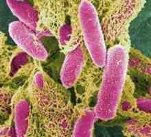 Nebezpečný Escherichia coli? Co když se zjistilo, že moč Escherichia coli?