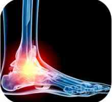 Co dělat s osteoartritidou nohy?