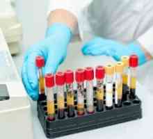 Co by mělo obsahovat normální zdravé analýzu lidské krve