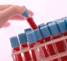 Co je to - krevní test Petit: hodnota, norma a riziko odchylek od normy