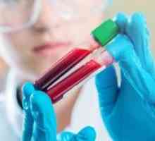 Co je to - GMT: jmenování na krevní test, rychlost enzymu a možného onemocnění