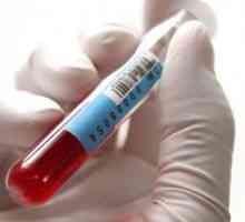 Alp normou v biochemické analýze krve a způsobuje, že abnormality enzymů